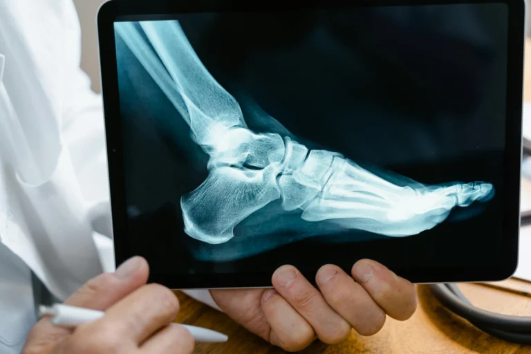 Any other injury acciden
